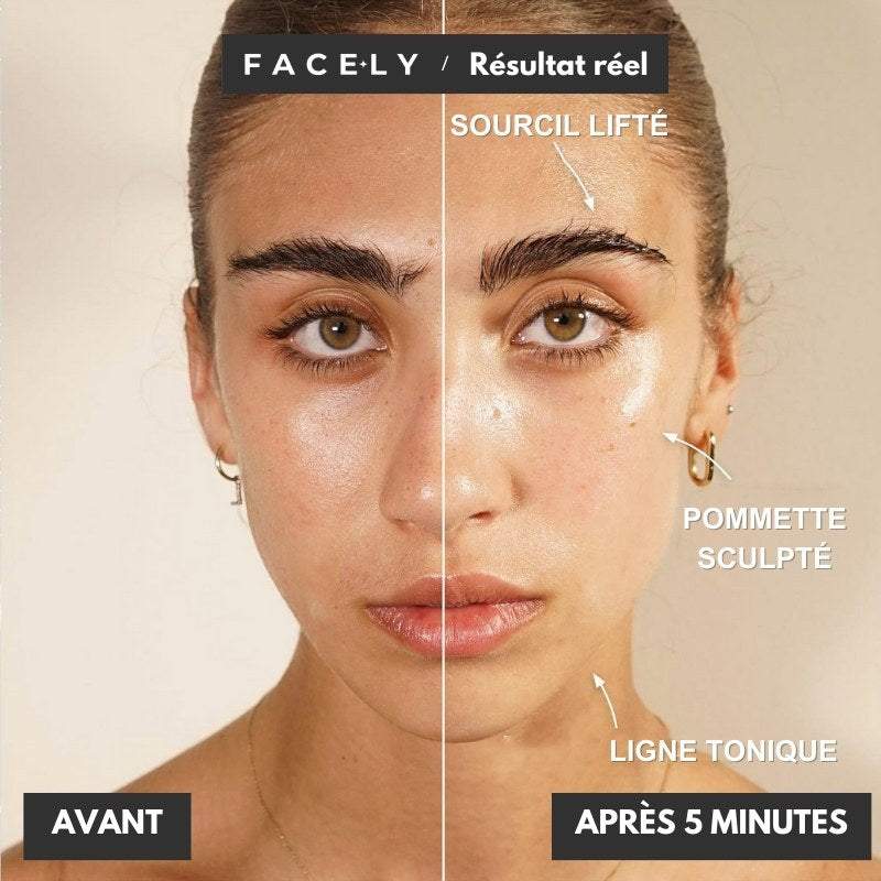 Microcourant Lifting Naturel - FaceLyft