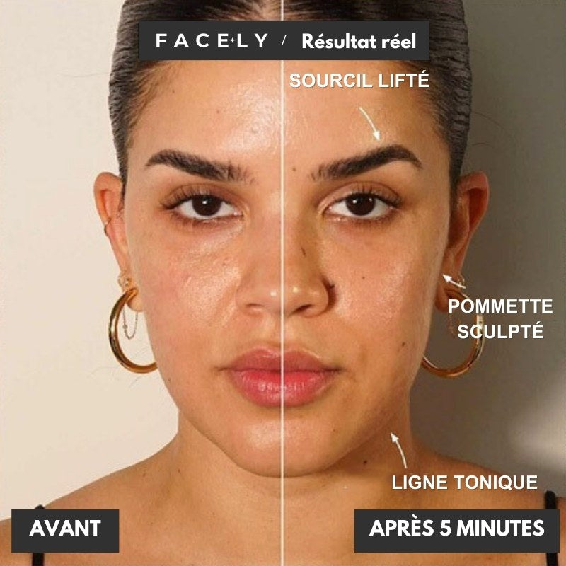 Microcourant Lifting Naturel - FaceLyft